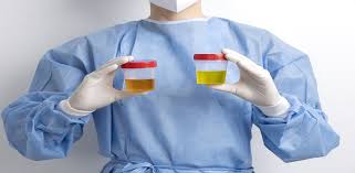 In-depth Look at Thyroid Profile and Urine Culture Testing in Bangalore