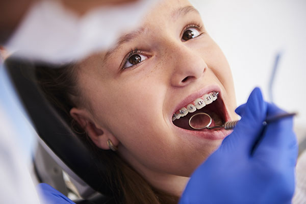 When Should Your Child See an Orthodontist? Early Signs to Watch