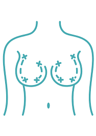 Elevate Your Beauty: Discovering the Best Breast Lift Options in Sydney