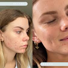 What My Face Told Me About Magnesium
