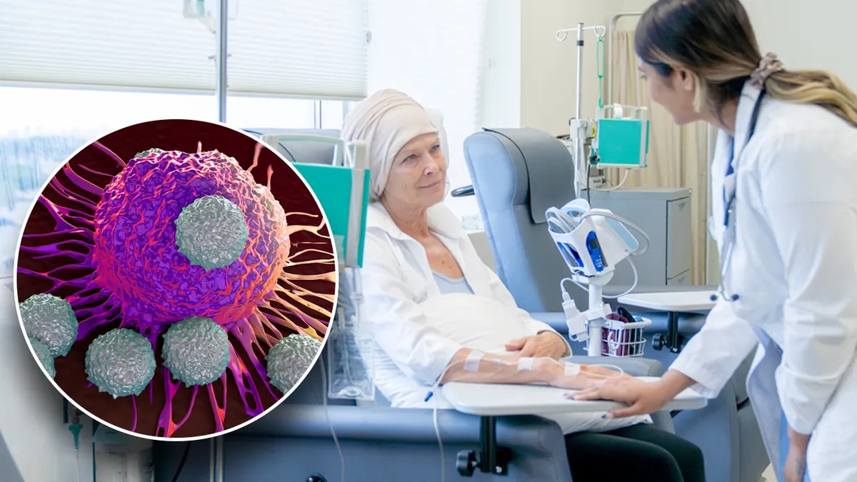 Understanding Radiation Therapy