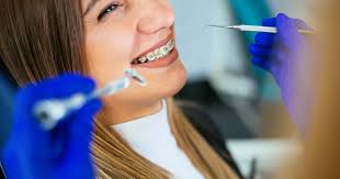 What Las Vegas Patients Should Know About Needing Braces